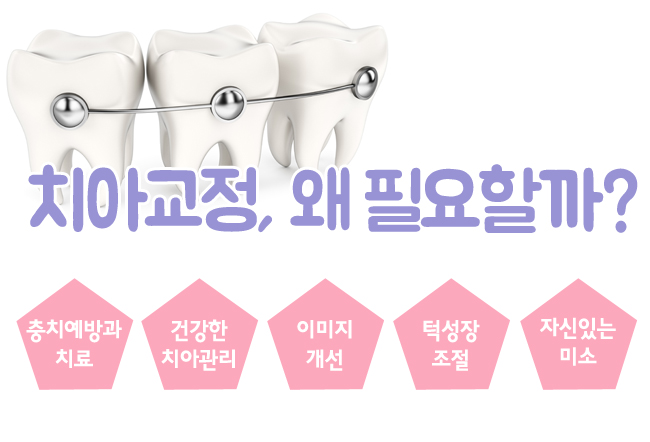 종각역치아교정 확실한 효과~! 관련 이미지 2