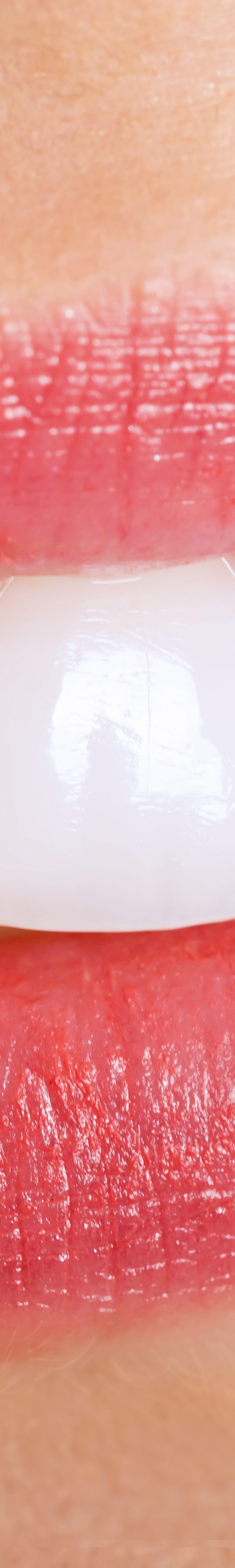 [종각역치과] 치아가 누렇게 보이는 진짜 이유, 미백 전에 꼭 알아야 할 것들 관련 이미지 14