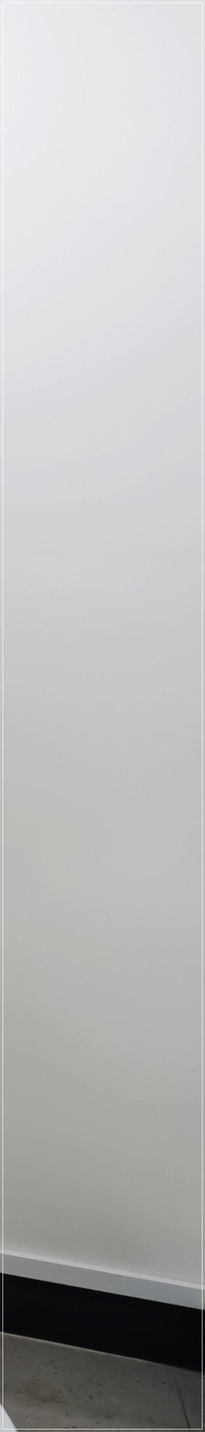 명동치과 임플란트 시술 전 어떤 것이 걱정되시나요? 관련 이미지 37