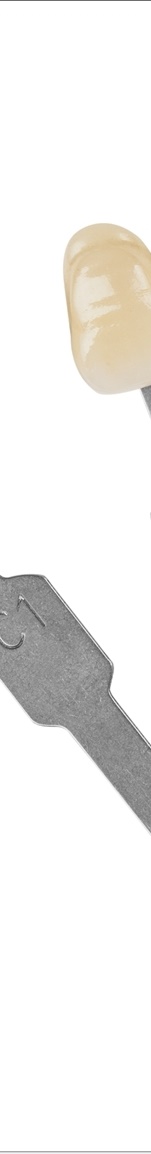 광화문치과 라미네이트 치료 전 고민해야 할 것 관련 이미지 5