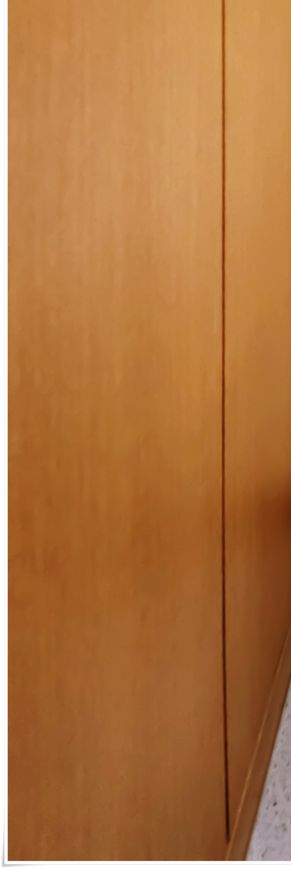 명동치과 저작력을 회복하기 위해서는? 관련 이미지 37