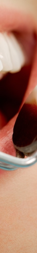 광화문치과 치아미백 그 후 관련 이미지 15