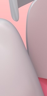 명동역치과 라미네이트 삭제된 치아는 다시 자라지 않습니다. 관련 이미지 21