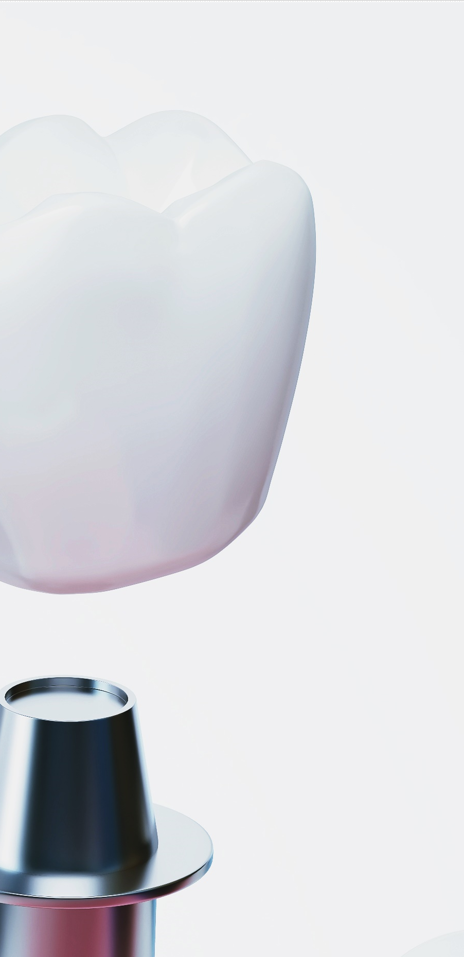 종각역치과 임플란트 치료, 이것만은 알고 계세요! 관련 이미지 39