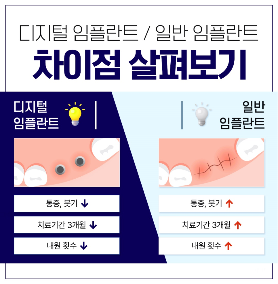 종로임플란트 건강한 치아를 위한 현명한 선택 관련 이미지 5