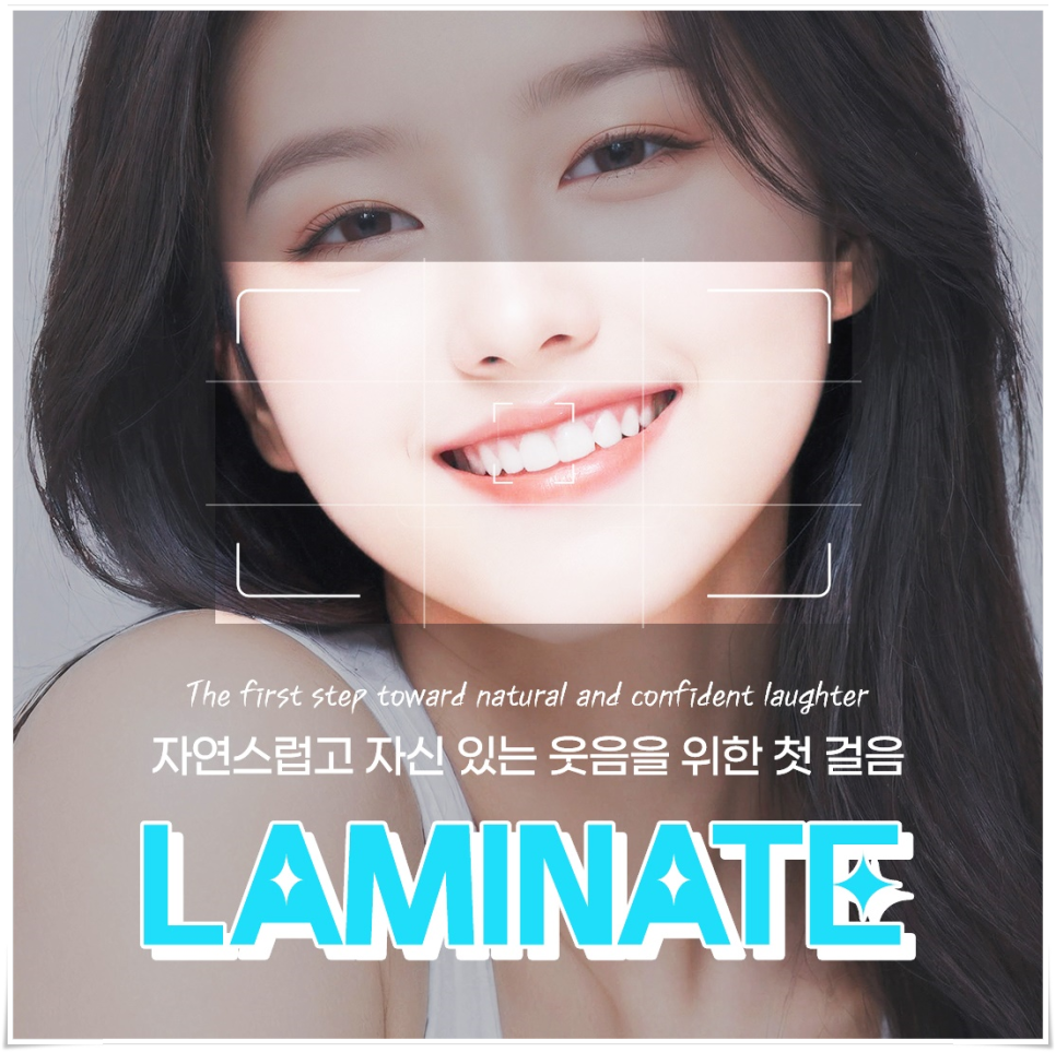Laminate Veneers Explained by Jonggak Station Dental Clinic: Treatment Duration, Candidates, Benefits, and Everyday Changes image 1