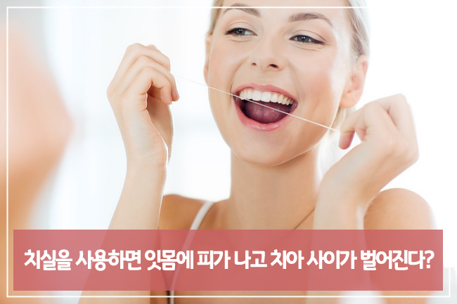 치실에 대한 잘못된 상식! 관련 이미지 2