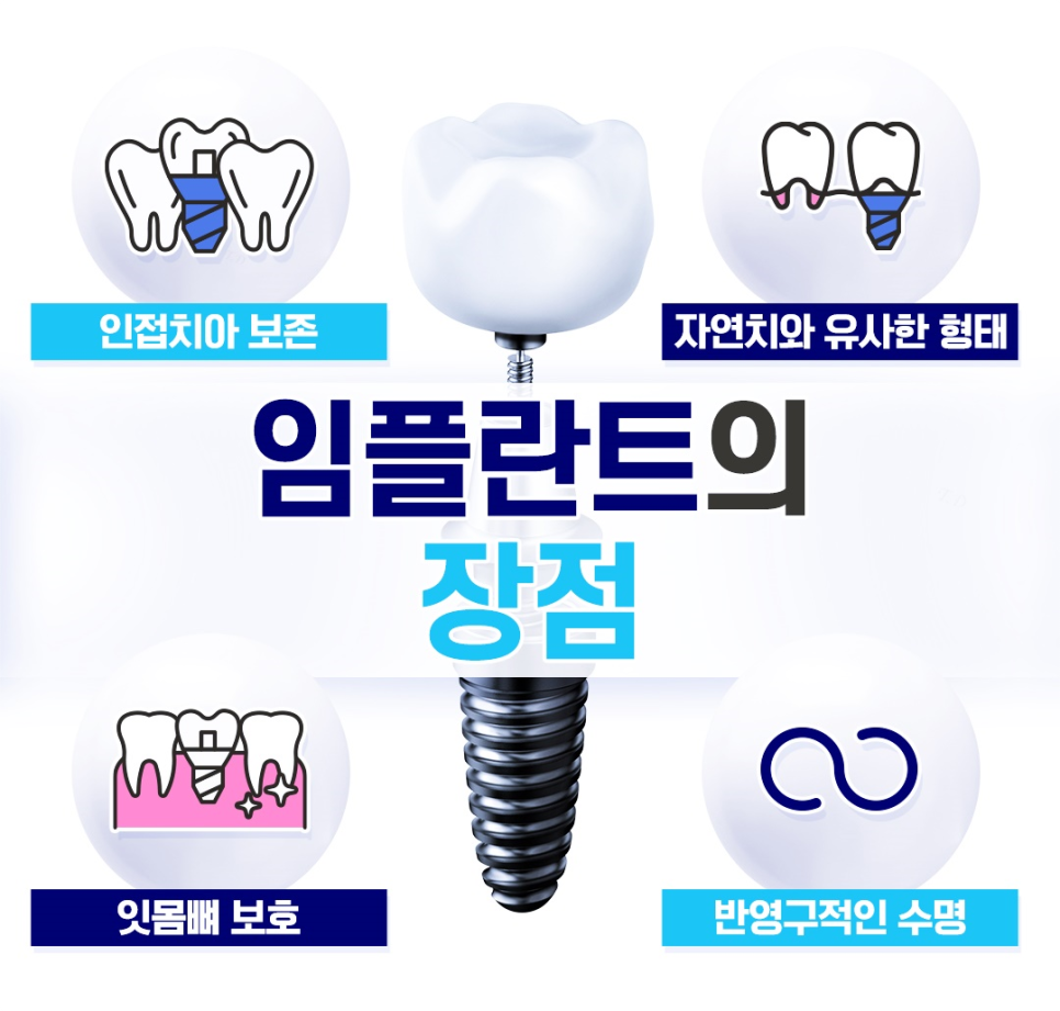 종로치과 치아가 빠져있는 상태여서 임플란트 고민하고 계신가요? 관련 이미지 2