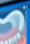 Jongno Dental Implants: Fast and Accurate Treatment Using Digital Technology image 27