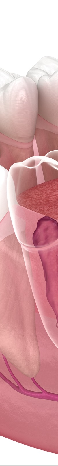 종각역치과 자연치아를 살리기 위한 대책, 신경치료 관련 이미지 11