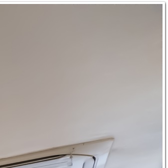 종각치과의 치아미백으로 하얀 미소 찾기 관련 이미지 18