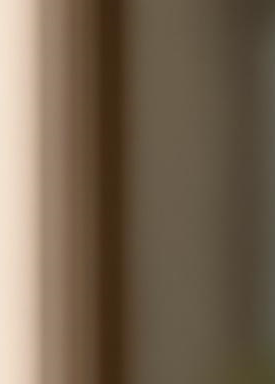 Laminate Veneers Explained by Jonggak Station Dental Clinic: Treatment Duration, Candidates, Benefits, and Everyday Changes image 19