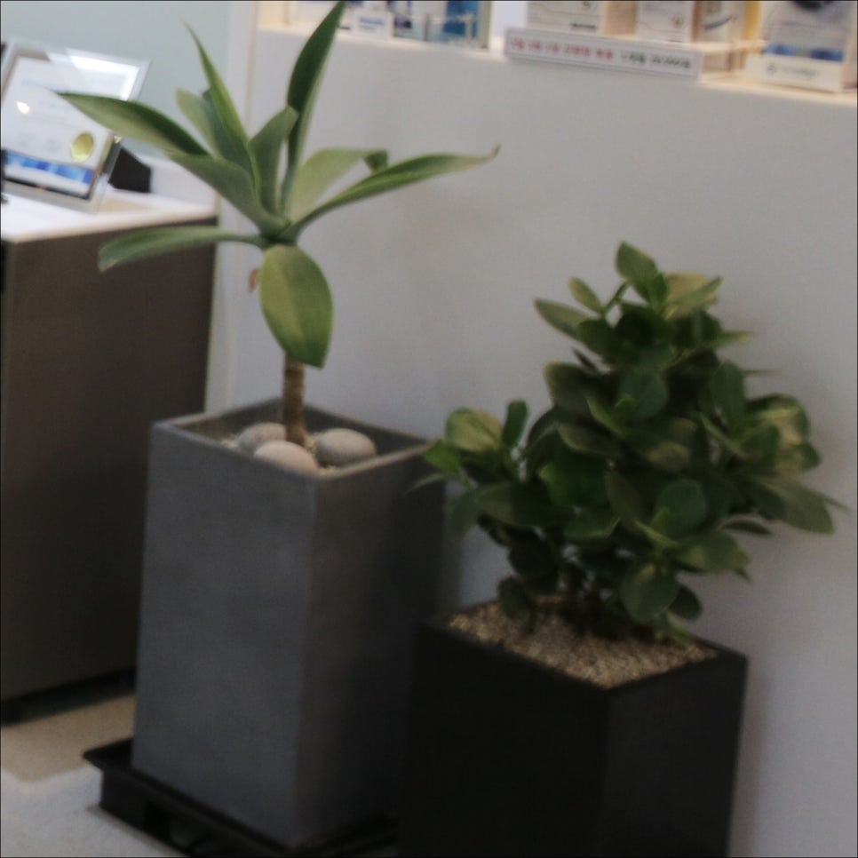 광화문역치과 상실한 치아 바로 해결을 해줘야 하는 이유 관련 이미지 14