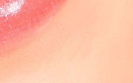 종로치과 치아미백 밝고 환하게 관련 이미지 24