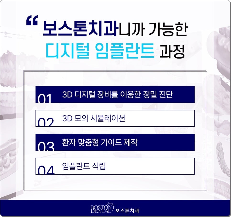 을지로치과에서 야간진료로 누구나 임플란트 치료를 받아요. 관련 이미지 4