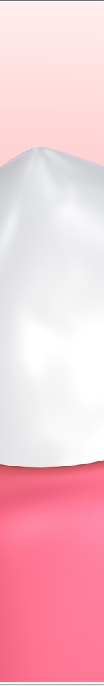 광화문치과 라미네이트 치료 전 고민해야 할 것 관련 이미지 19