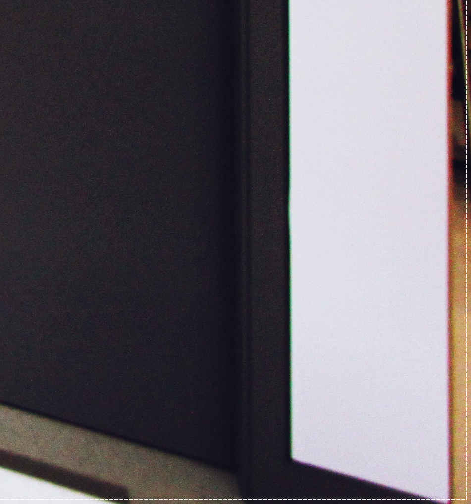 을지로치과 투명해서 티가 안 나게 교정할 수 있어요 관련 이미지 31