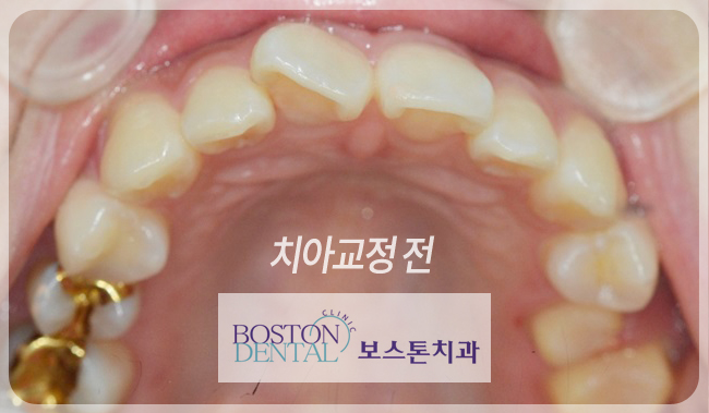 종로치아교정 안심하고 시작! 관련 이미지 3