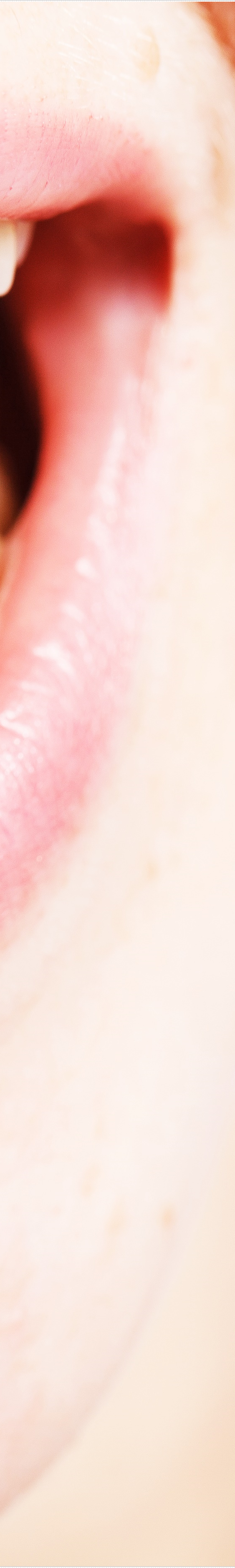 을지로입구역치과에서 알려드리는 치아미백과 라미네이트의 모든 것 관련 이미지 15