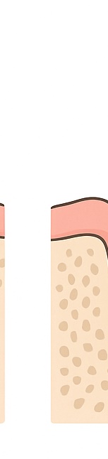 종각치과 임플란트 치료 후 관리 관련 이미지 9