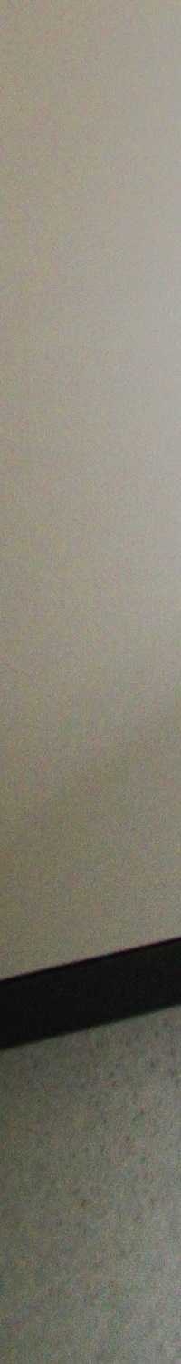 명동역치과 일상생활 중 치아가 흔들린다면 관련 이미지 18