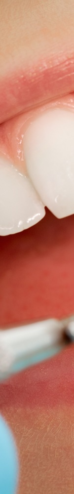 광화문치과 치아미백 그 후 관련 이미지 12