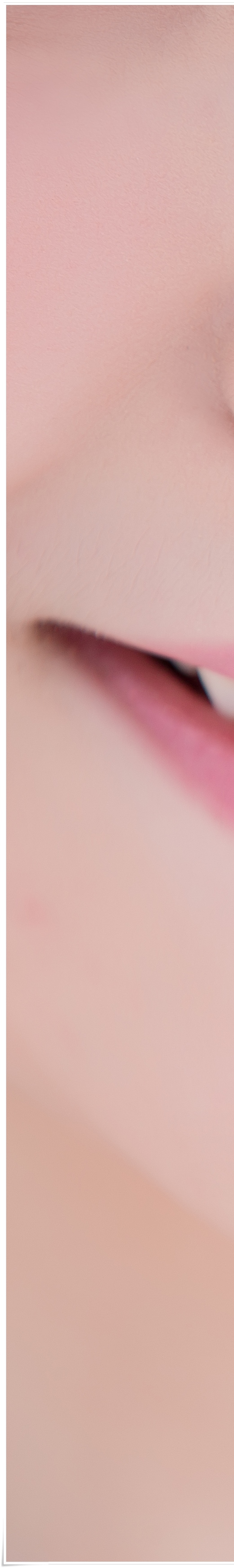 명동치과 라미네이트로 환하게 스마일~ 관련 이미지 9