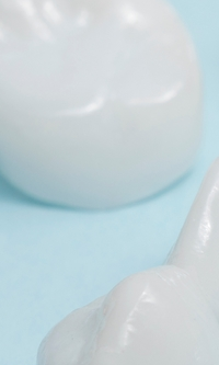 명동치과 라미네이트와 올세라믹의 차이점 관련 이미지 30