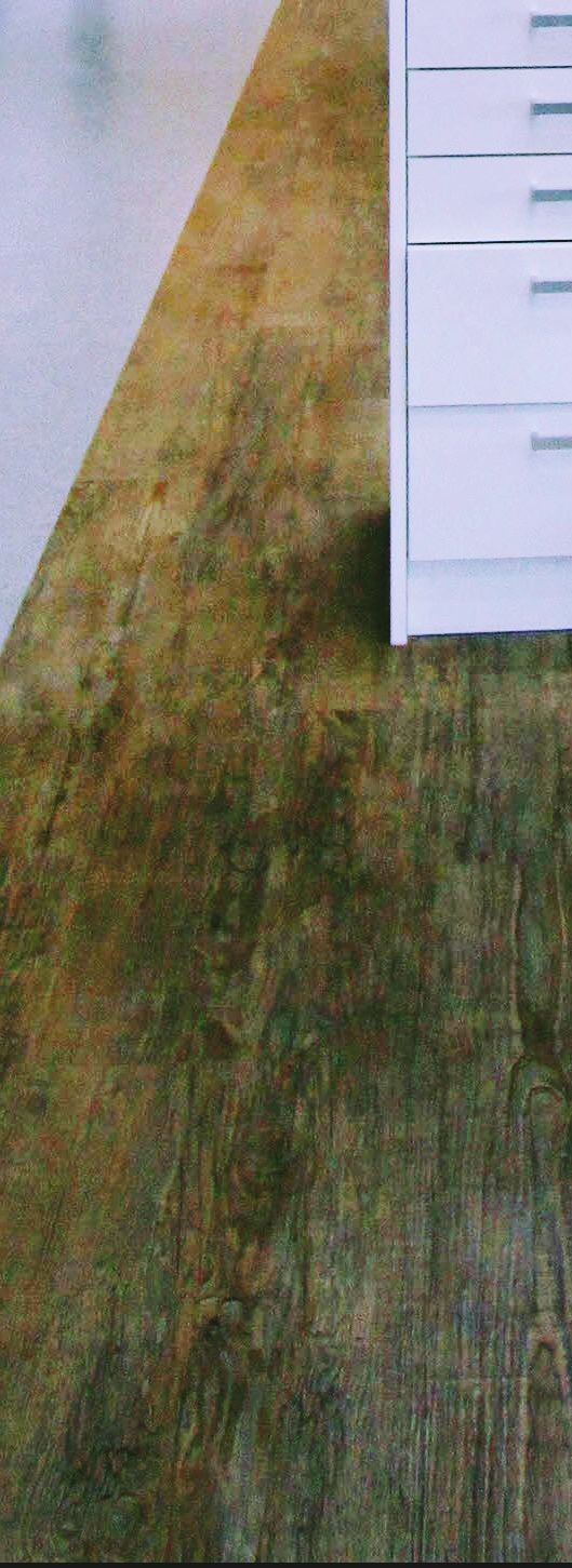 외국인치과 영어로 소통하여 정확하게 치료 관련 이미지 19