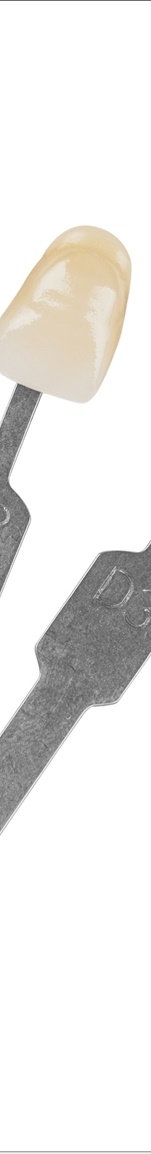 광화문치과 라미네이트 치료 전 고민해야 할 것 관련 이미지 10