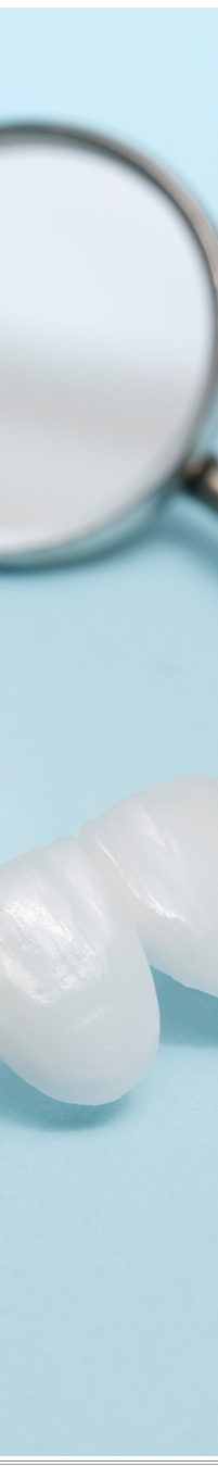 광화문역치과 치아미백과 라미네이트 나에게 필요한 건? 관련 이미지 41