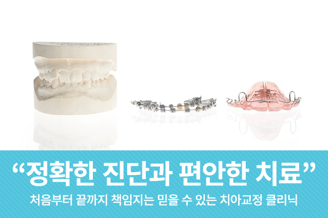 광화문치아교정 누구나 OK 관련 이미지 7