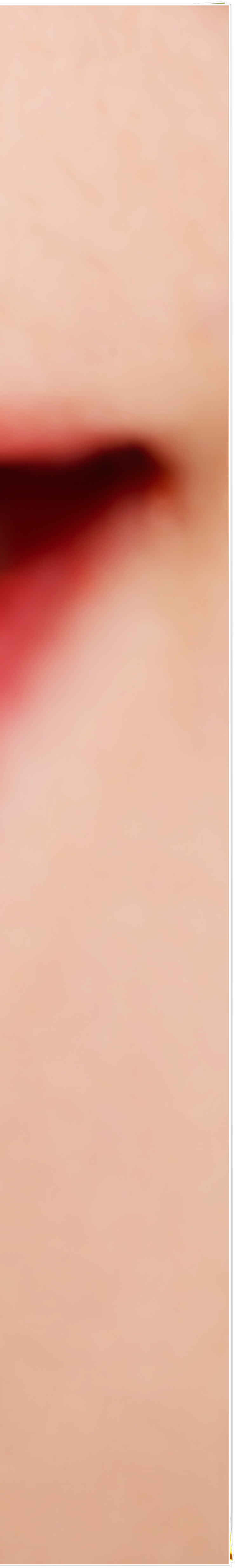 종로3가치과에서 알려드리는 무삭제 라미네이트 완벽 가이드 관련 이미지 19