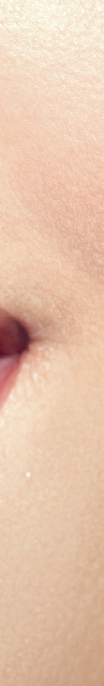 광화문역치과 치아미백과 라미네이트의 차이는? 관련 이미지 11