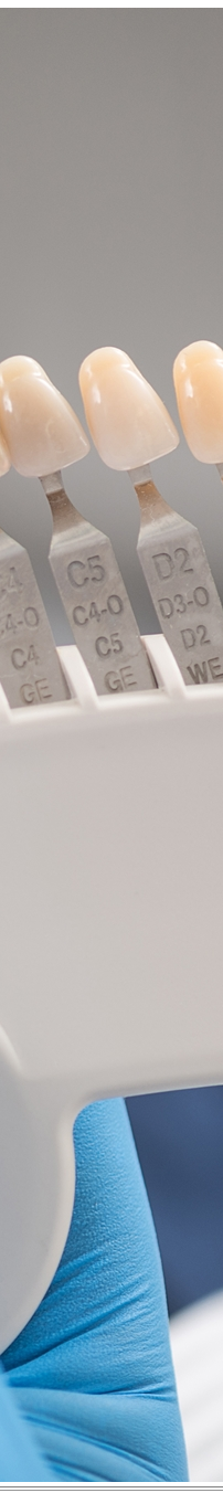 광화문역치과 치아미백과 라미네이트 나에게 필요한 건? 관련 이미지 22