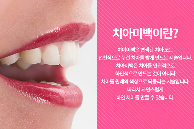 종로치과추천, 예쁜 미소 만들기 관련 이미지 4