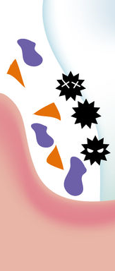 Cavity Treatment, Root Canal Treatment, and Essential Cavity Prevention Tips from a Jongno-gu Dental Clinic! image 25