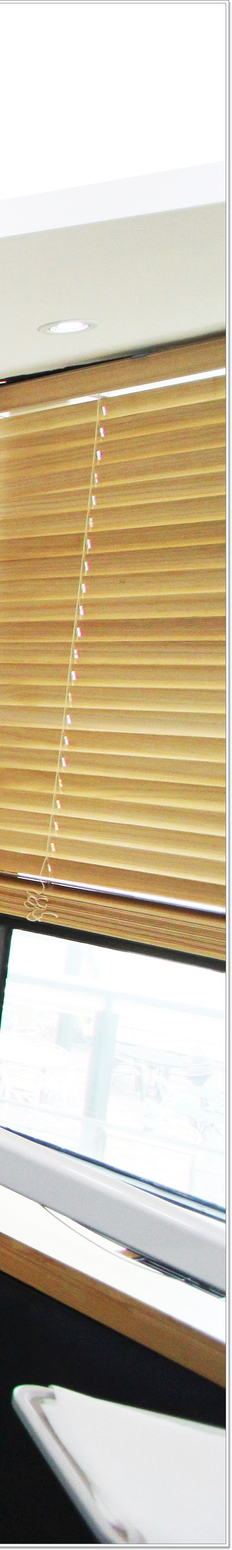 명동치과 상실부위는 임플란트로 관련 이미지 39