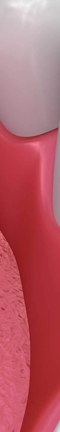 명동치과 주변 치아와 자연스러운 라미네이트 하는 방법 관련 이미지 24