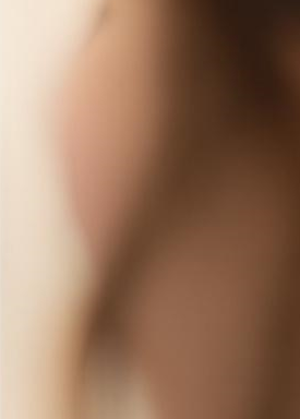 Laminate Veneers Explained by Jonggak Station Dental Clinic: Treatment Duration, Candidates, Benefits, and Everyday Changes image 25