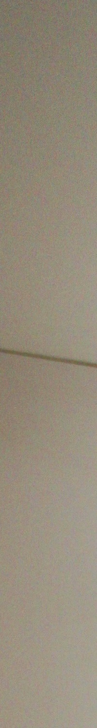 명동역치과 일상생활 중 치아가 흔들린다면 관련 이미지 8