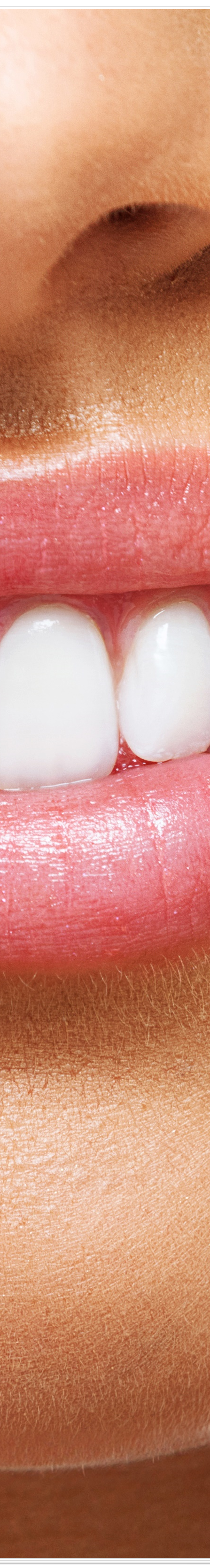 종로치과에서 알려드리는 치아미백과 라미네이트의 모든 것 관련 이미지 15