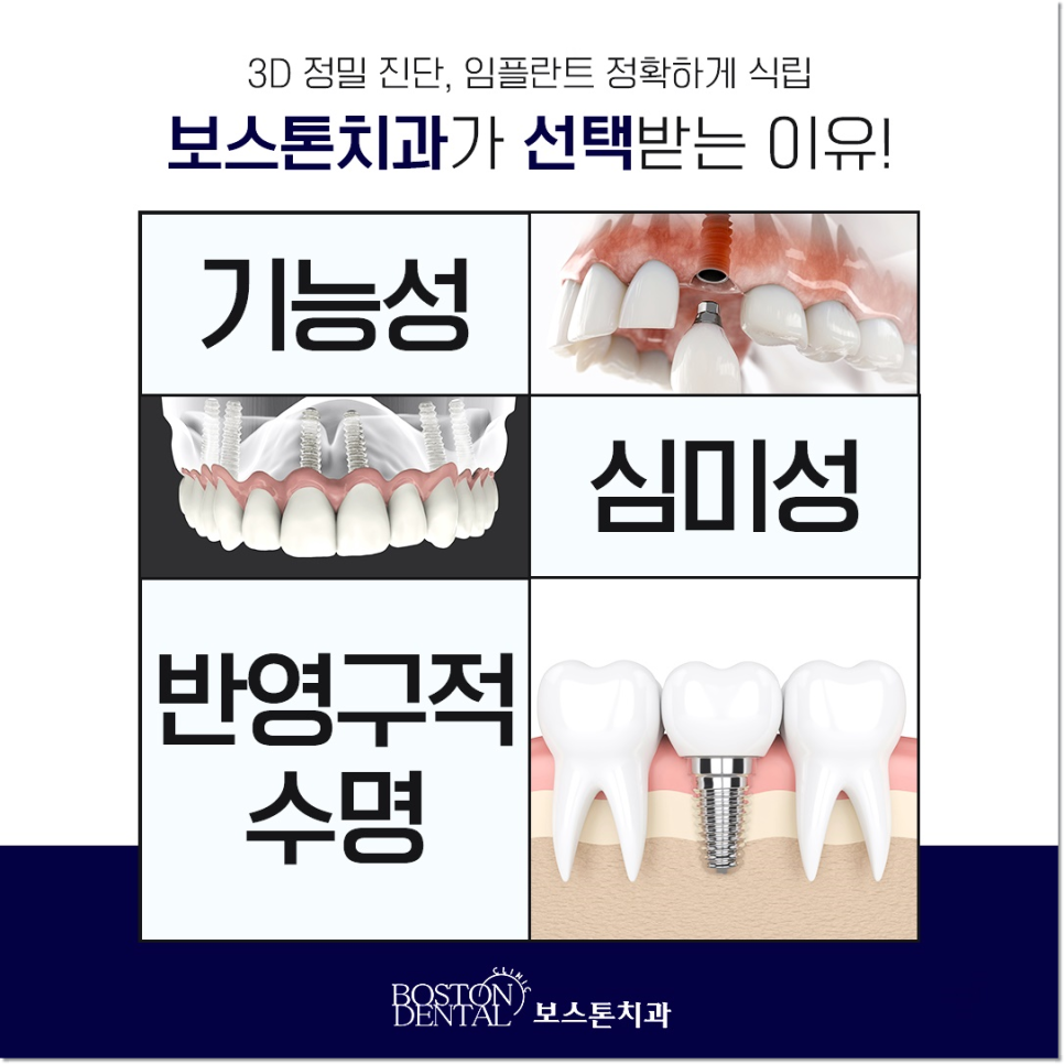 명동치과 임플란트에 대해 하나부터 열까지 관련 이미지 3