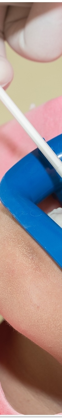 광화문역치과 생활습관에 따른 맞춤형 미백 관리 관련 이미지 19