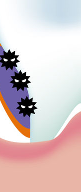 Cavity Treatment, Root Canal Treatment, and Essential Cavity Prevention Tips from a Jongno-gu Dental Clinic! image 21