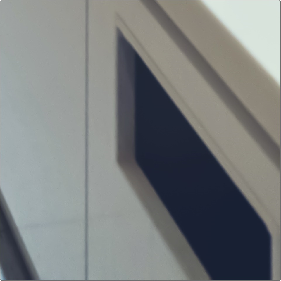 종각역 치과 임플란트 잘 마무리하기 위해서 관련 이미지 13