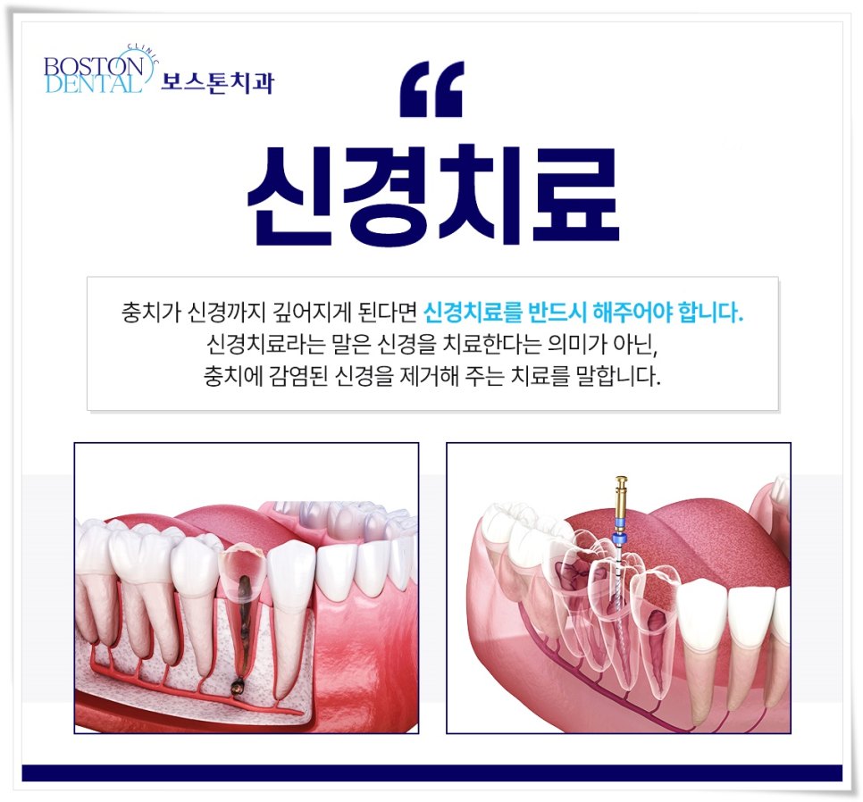 종각역 치과 점심시간에도 편하게 진료 보세요 관련 이미지 5