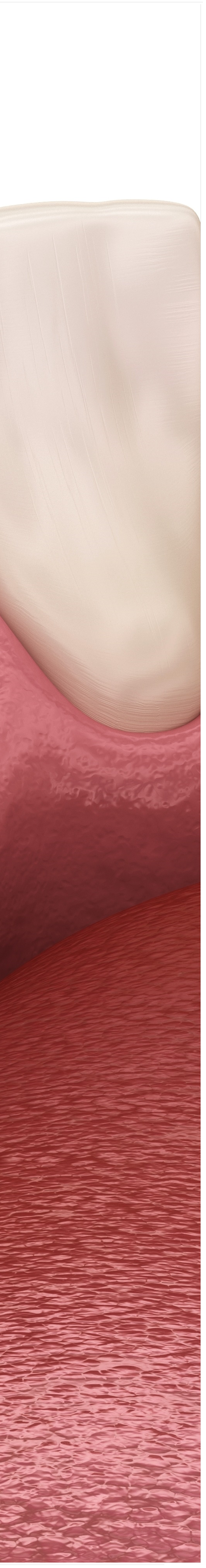 명동치과 치아가 욱씬욱씬 아프신가요? 관련 이미지 39