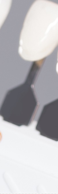 종로치과 라미네이트 주변 치아를 확인하여 자연스럽게 관련 이미지 20