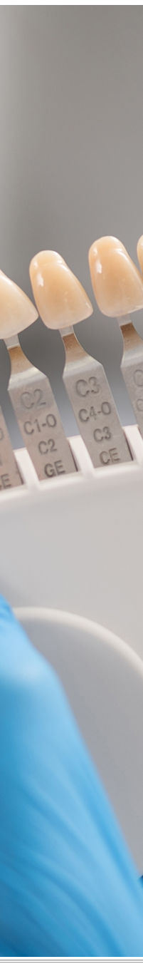 광화문역치과 치아미백과 라미네이트 나에게 필요한 건? 관련 이미지 21